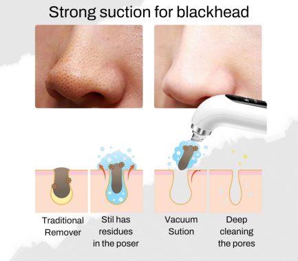 Vacuum Blackhead  Remover - Image 4